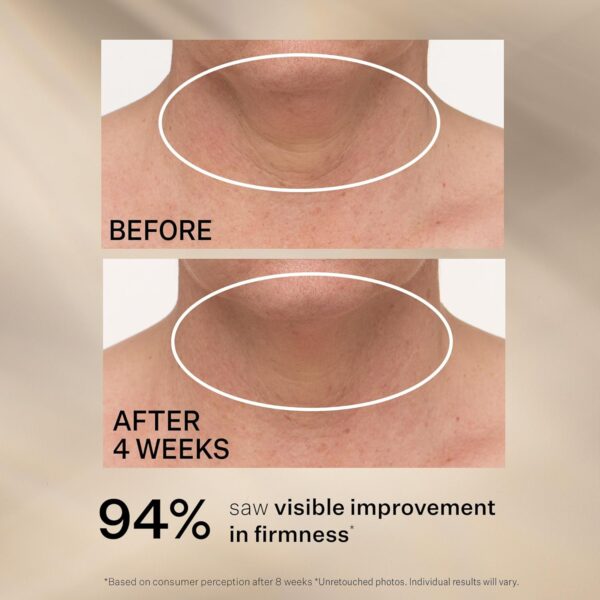 StriVectin Tighten & Lift Advanced Neck Cream PLUS with Alpha-3 Peptides for Neck & Décolleté, Smoothing Look of Wrinkles & Fine Lines, Improves Crepey Skin & Vertical Lines, for Soft Smooth Skin