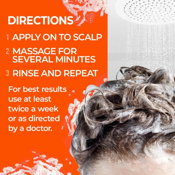 Medicasp Coal Tar Anti-Dandruff Shampoo, Alleviates Symptoms from 1st Wash, Treats Psoriasis, Seborrheic Dermatitis & Itchy Dry Scalp, Fights the Root Cause of Dandruff, Flakes Shampoo, 6 fl oz