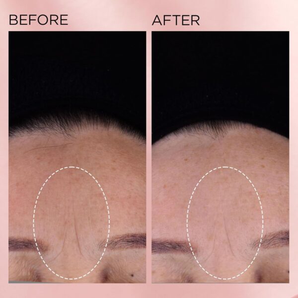 Elizabeth Arden Retinol + HPR Ceramide Rapid Skin Renewing Anti-Aging Face Serum Capsules, Fine Lines & Wrinkles Treatment with Peptides, Vitamin E, & Niacinamide