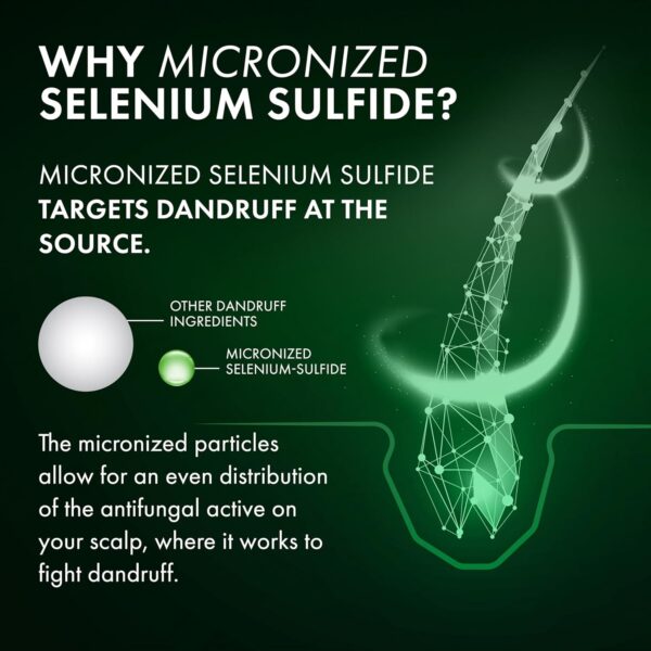 Dercos Selenium Sulfide Anti Dandruff Shampoo, Dry Scalp Treatment and Itch Relief. Prescription Strength Comparable to 2% Ketoconazole, for Mild to Severe Dandruff-Prone Hair & Flaky, Itchy Scalps