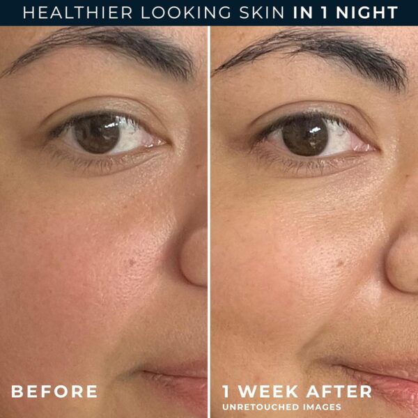 RoC Barrier Renew Night Moisturizer with Ceramides & Antioxidant Green Tea and Lipo Peptides to Renew Skin Barrier, (2.5 oz) with Retinol Eye Cream Packette