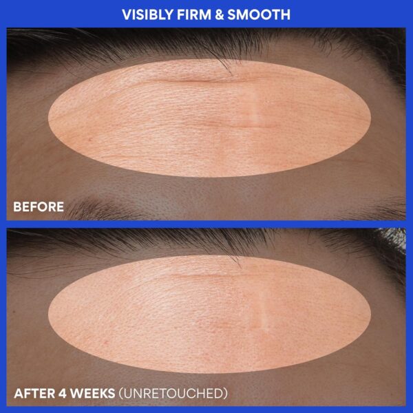 81zs0RJHgpL._SL1500_.jpg innisfree Green Tea Retinol PDRN Firming Serum, Vegan Korean Skincare for Fine Lines and Skin Texture