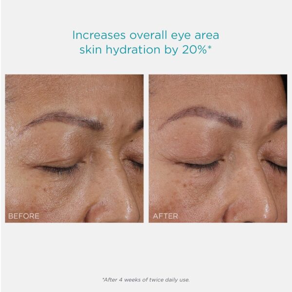 NEOSTRATA RESTORE Hydra Filling PHA Eye Cream, Hydrating and Lifting Anti-Aging Eye Treatment for Fine lines & Wrinkles with Hyaluronic Acid, Vitamin C& E, and Green Tea Extract, 0.5oz