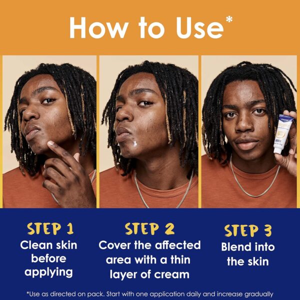 Clearasil Stubborn Acne Control 5in1 Spot Treatment Cream, 1 oz