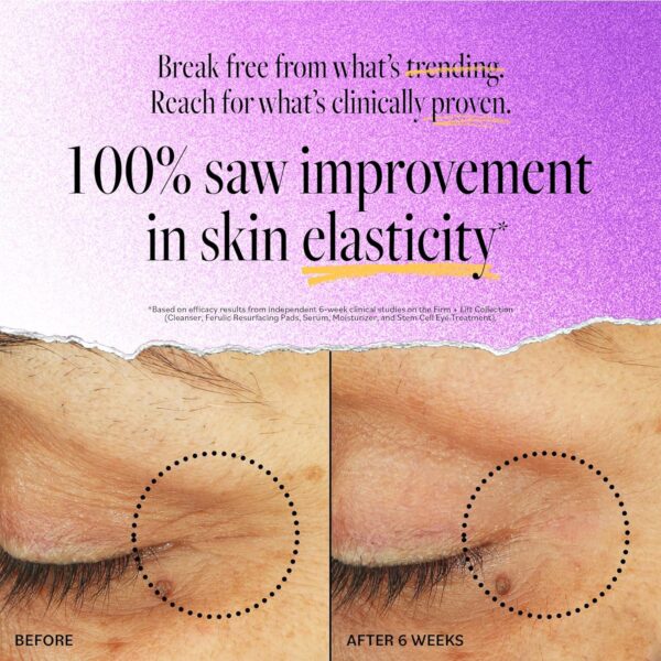 Derma E Stem Cell Lifting Eye Treatment – Multi Action Firming and Tightening Under Eye and Upper Eyelid Cream - Hydrating and Revitalizing Moisturizer, 0.5oz