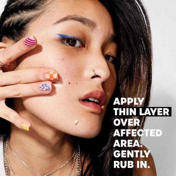 THAYERS Rapid Acne Treatment with 10% Sulfur, Sulfur Acne Treatment with Niacinamide and Glycolic Acid, Soothing and Non-Stripping Skin Care, 0.68 Fl Oz