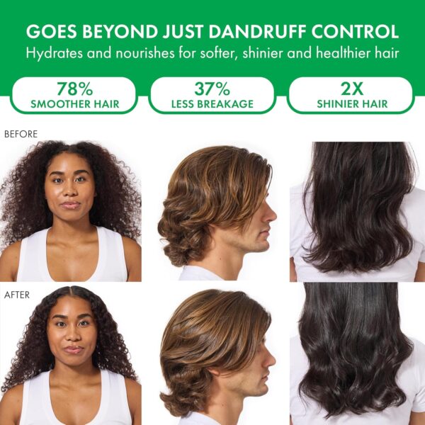 Dercos Selenium Sulfide Anti Dandruff Shampoo, Dry Scalp Treatment and Itch Relief. Prescription Strength Comparable to 2% Ketoconazole, for Mild to Severe Dandruff-Prone Hair & Flaky, Itchy Scalps