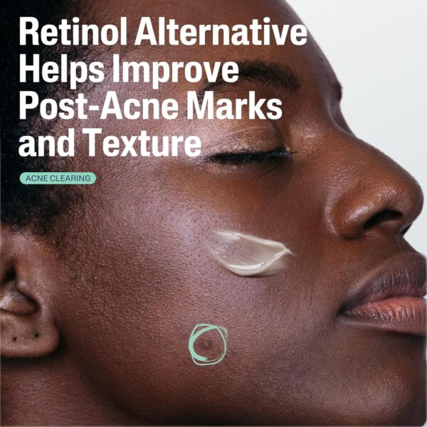 CETAPHIL Gentle Clear Repairing Post-Acne Serum, Retinol Alternative, Oil Free Serum for Sensitive Skin, 1 Fl Oz, Bakuchiol, Improves Skin Tone & Post-acne Marks, Dermatologist Recommended Brand