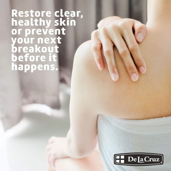 De La Cruz Sulfur Ointment - Cystic Acne Treatment for Face and Body - Daily 10 Min Spot Treatment Mask - Safe and Effective Game Changing Hormonal Acne Treatment that Clears Up Pimples 2.6oz (6 Pack)