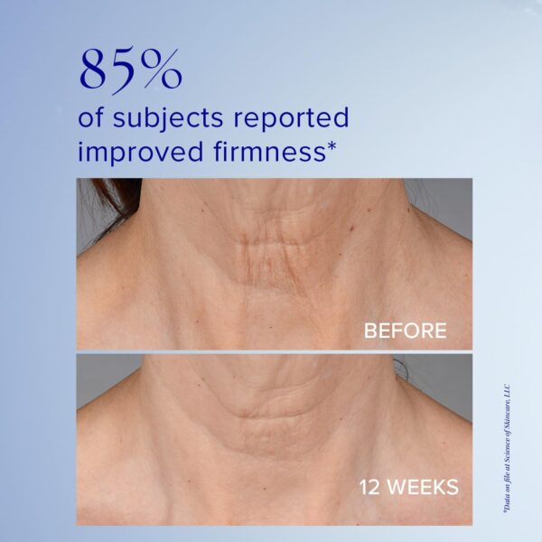 iS CLINICAL Neckperfect Complex, Neck Firming Cream, Anti-Aging Neck Lift, Neck Tightening Cream