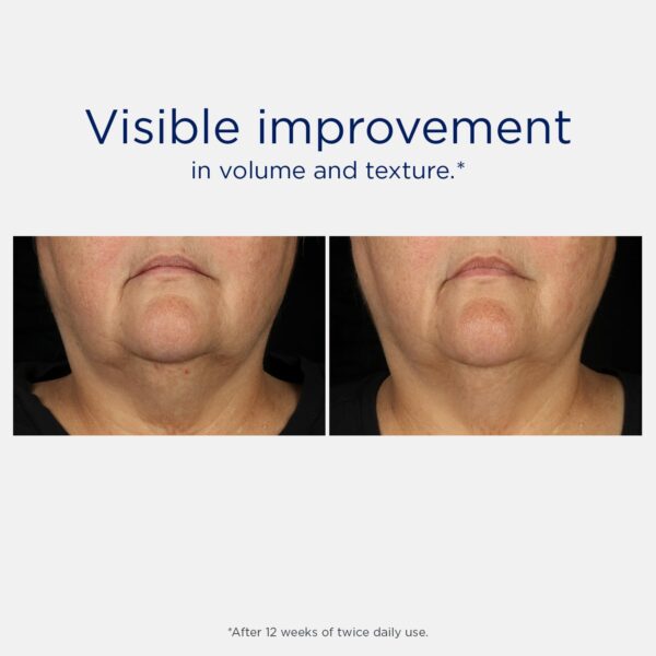 NEOSTRATA Skin Active Tri-Therapy Lifting Serum, Anti-Aging and Firming 3D Volumizer with MicroDiPeptide229 for Fine Lines & Wrinkles, Hyaluronic Acid, Oil-Free, Fragrance-Free, 1 fl. oz.