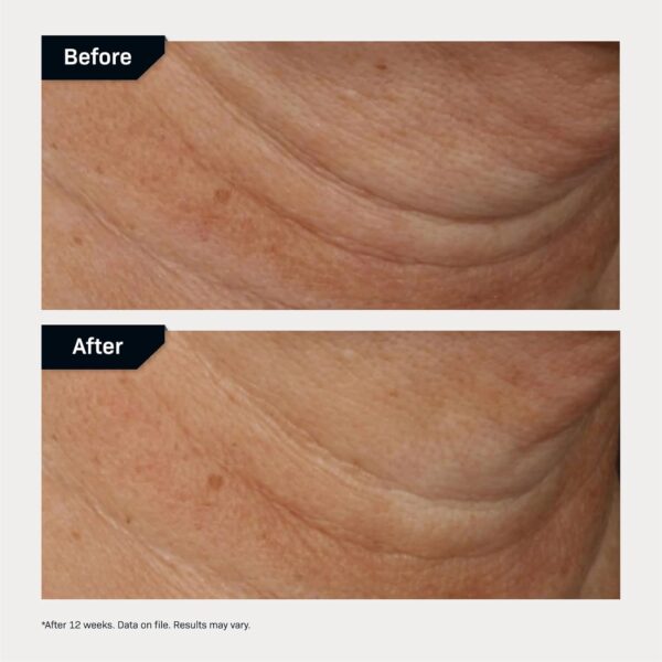 Revision Skincare Nectifirm® Advanced, Anti Aging Neck Firming Cream with Peptides for Fine Lines, Wrinkles and Crepey Skin