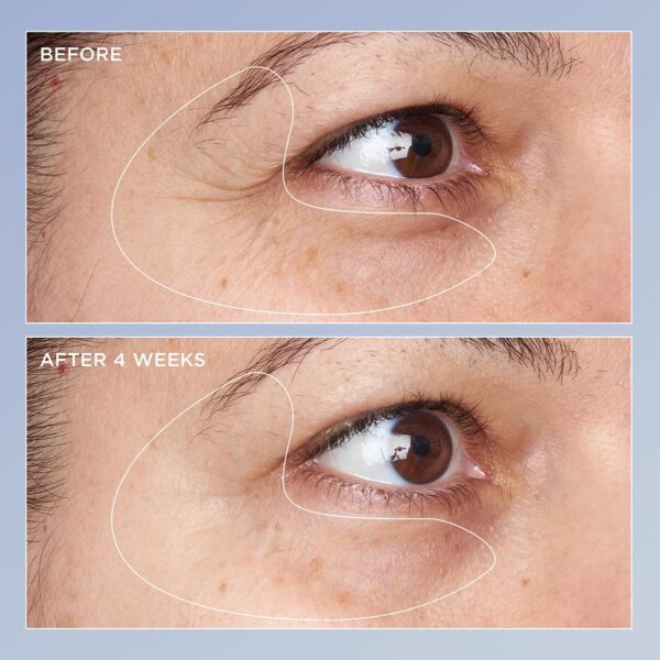 Perricone MD High Potency Triple Retinol Renewal Eye Serum, 0.5 fl. oz.