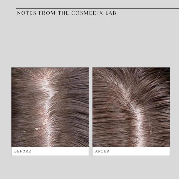 COSMEDIX Fortify Cooling Enzyme Scalp Treatment, 1 ct.