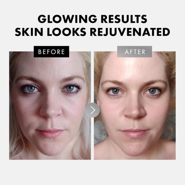 Eclat Skincare Face Serum Set – Vitamin C, Retinol, Hyaluronic Acid for Hydration & Anti-Aging – Brightening & Firming Facial Serums – 3 Pack Face Care Set