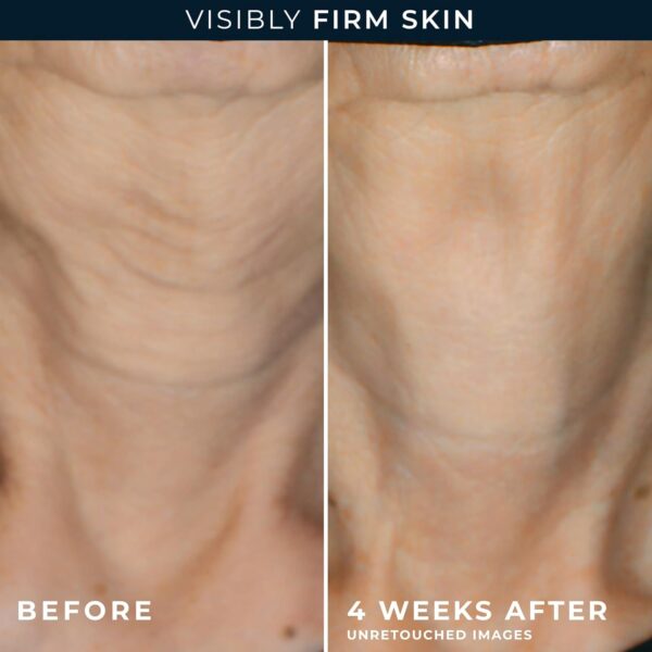 RoC Crepe Repair Anti Aging Daily Face Moisturizer & Neck Firming Cream (1.7 oz) + RoC Retinol Wrinkle Smoothing Capsules (7 CT), Skin Care Routine for Women and Men