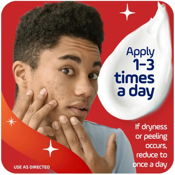 Asepxia Acne Treatment Cream for Face, 2% salicylic acid, Rapid Maximum Strength Acne Treatment, Clears Pimples and Blackheads, Prevents New Acne and Controls Excess Oil, 1 oz (Pack of 3)