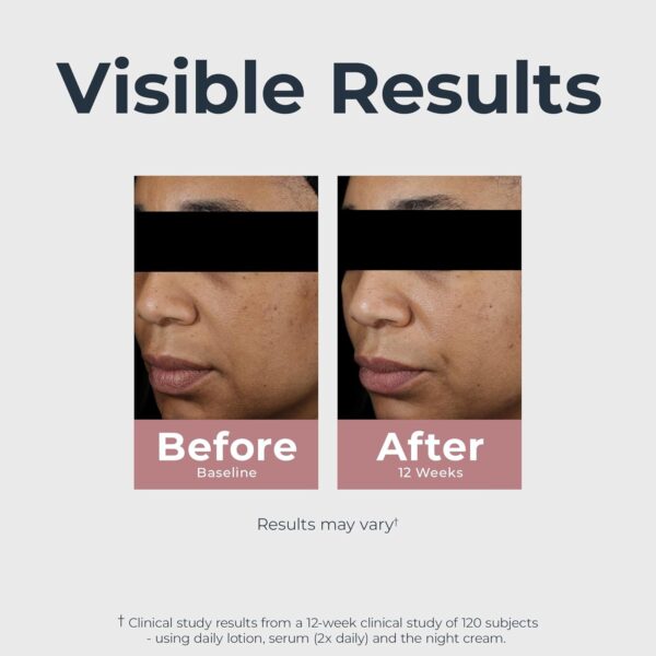 71spu9MAHQL._SL1500_.jpg Eucerin Radiant Tone Dual Serum Dark Spot Corrector, Dark Spot Serum with Thiamidol and Hyaluronic Acid, Helps Visibly Reduce the Look of Persistent Dark Spots, 1 Fl Oz Bottle