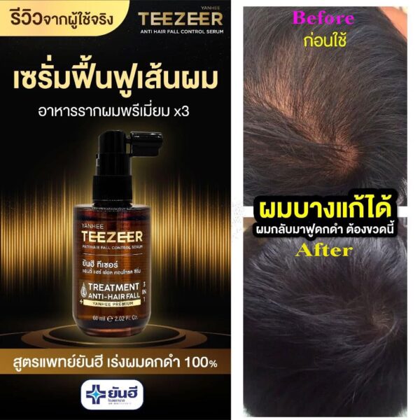 Yanhee Teezeer Anti Hair Fall Nourishes hair roots Control Serum 60 ml