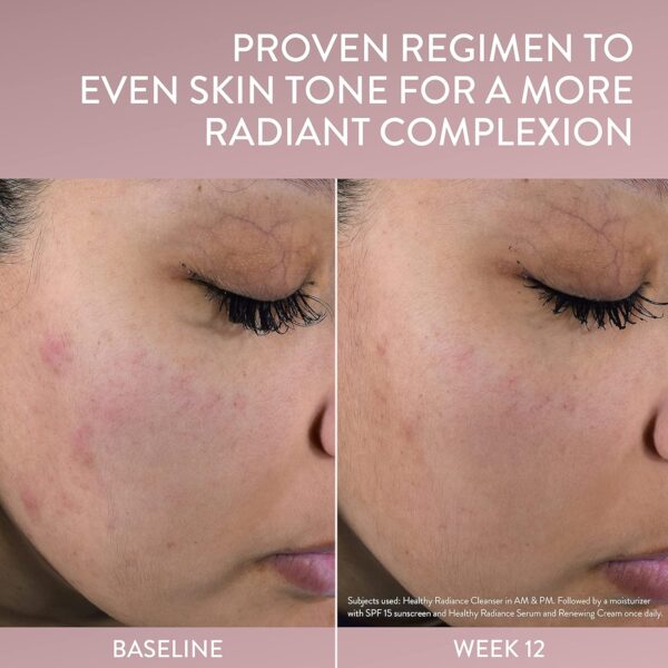 Cetaphil Face Day Cream, Healthy Radiance Whipped Day Cream w/SPF 30, Visibly Reduces Look of Dark Spots, Brightening Lotion, Designed for Sensitive Skin, Hypoallergenic, Fragrance Free, 1.7oz