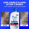 Head & Shoulders Mens 2 in 1 Dandruff Shampoo and Conditioner, Anti-Dandruff Treatment, Old Spice Swagger for Daily Use, Paraben Free, 31.4oz, 2 PACK