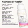 Pacifica Acne Spot Treatment & Pimple Cream – Dry It Out Gel with 2% Salicylic Acid, Witch Hazel, Niacinamide – Dries Blemishes Overnight, Fights Breakouts & Redness, For Teens & Adults, Vegan Clean