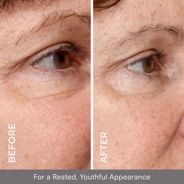 COSMEDIX Under Eye Serum for Dark Circles & Puffiness, Opti Crystal - Lifting & Firming Liquid Serum for Fine Lines & Wrinkles - Brightening, Moisturizing, & Hydrating Anti Aging Eye Puffy Bags Serum