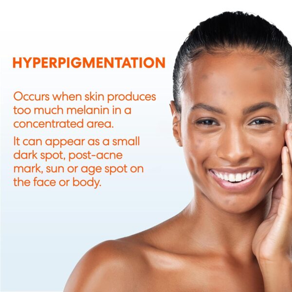 Palmer's Skin Success Anti-Dark Spot Fade Cream with Vitamin E and Niacinamide, Helps Reduce Dark Spots and Age Spots, Suitable for All Skin Types 2.7 Ounce