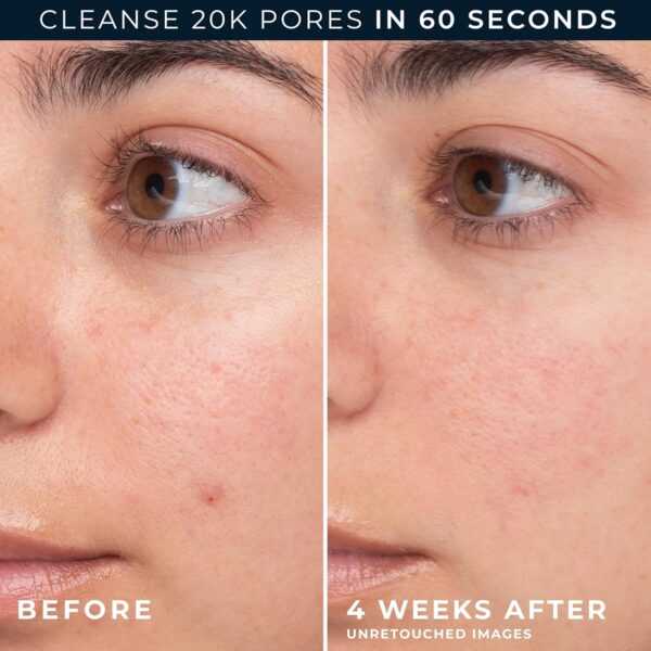 RoC Barrier Renew Gel to Foam Non Drying Facial Cleanser to Hydrate Skin, 12 Ounces