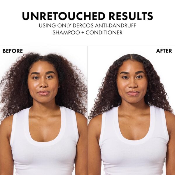 Dercos Hair & Scalp Moisturizing Conditioner, Formulated With Glycerin, Niacinamide + Hyaluronic Acid, Hair Conditioner & Scalp Moisturizer, Strengthens, Post Dandruff Treatment, 6.7 Fl Oz