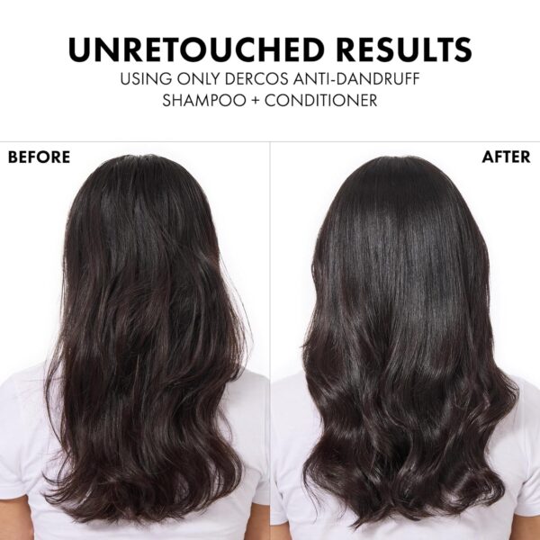 Dercos Hair & Scalp Moisturizing Conditioner, Formulated With Glycerin, Niacinamide + Hyaluronic Acid, Hair Conditioner & Scalp Moisturizer, Strengthens, Post Dandruff Treatment, 6.7 Fl Oz