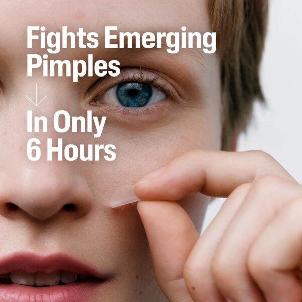 Cetaphil Acne Patches, Pimple Patches for Sensitive Skin, Formulated with Salicylic Acid, CICA, and Heartleaf Extract for Emerging Pimples, Visible Results in 6 Hours, 24 Count