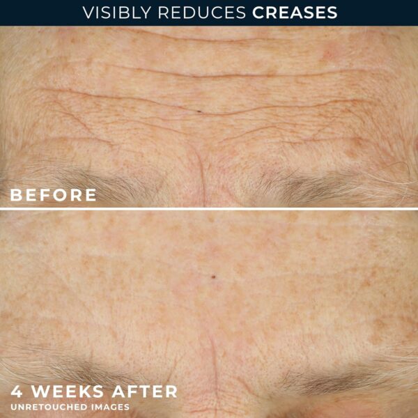 RoC Crepe Repair Anti Aging Daily Face Moisturizer & Neck Firming Cream (1.7 oz) + RoC Retinol Wrinkle Smoothing Capsules (7 CT), Skin Care Routine for Women and Men