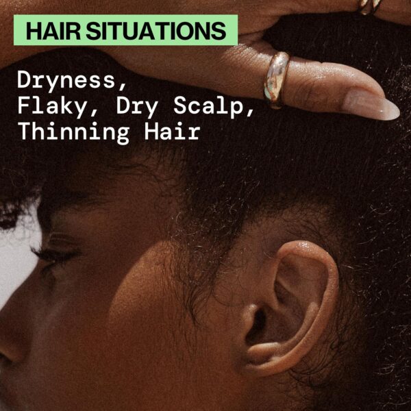 Pacifica Scalp Smoothie Hydrating Scalp Treatment & Leave-On Hair Mask, Cooling Relief for Dry, Flaky, Itchy Scalp & Thinning Hair, Vegan & Cruelty-Free, 6 fl oz