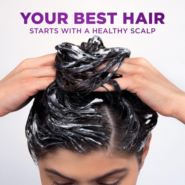 Head & Shoulders Scalp X Anti Dandruff Conditioner for Women, 5 Fl Oz Hair Treatment Reduces Hair Loss Due to Breakage and Provides Itchy Scalp Relief