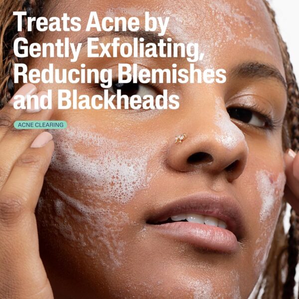 Cetaphil Gentle Clear Pore Clearing Acne Cleanser, Foaming Gel Cleanser for Sensitive, Acne-Prone Skin, 8 Fl Oz Pump Bottle, 2% Salicylic Acid, Gently Exfoliates, Dermatologist Recommended Brand